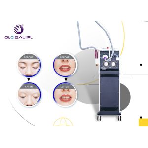 Narrow Pulse Width Pico Tattoo Removal Equipment 15Hz Frequency US506B Model