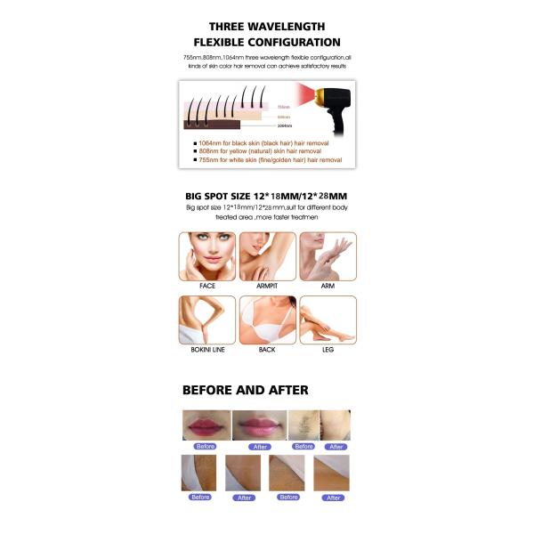 Ice Speed L 3 Wavelength Oem Commercial 808 Diode Laser Hair Removal Machine