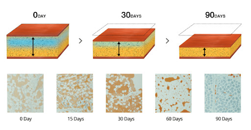 Dual Handles Fat Freeze Cryolipolysis Vacuum Slimming Machine