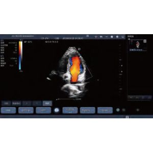 Mobile Phone Handheld Ultrasound Scanner Convex Linear Transvaginal Micro Convex