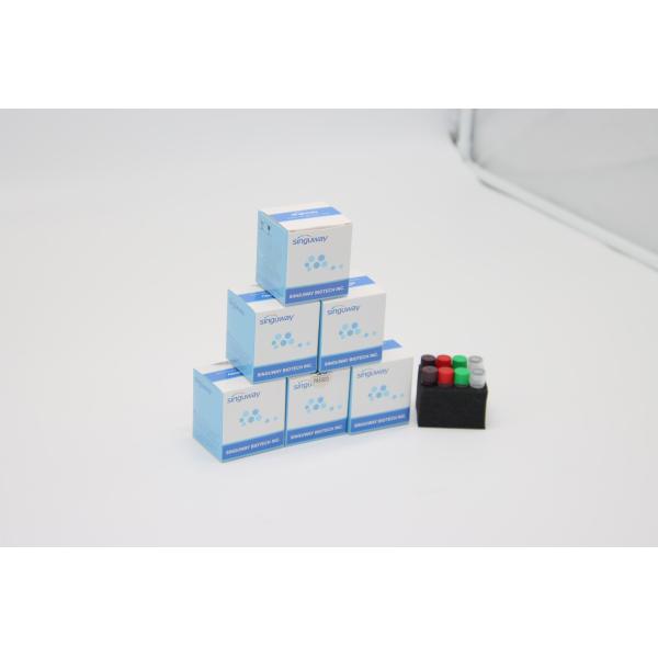 POCT IVD Clinical Diagnosis RT PCR Test Kit Real Time For HBV HCV