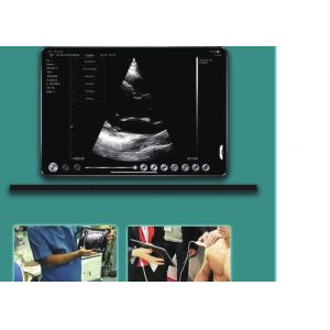 2.5mhz Dual Heads Convex Handheld Ultrasound Scanner