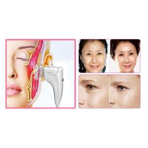 2D 3D HIFU Multifunction Beauty Machine With 15 Inch Touch Screen 440mm * 300mm