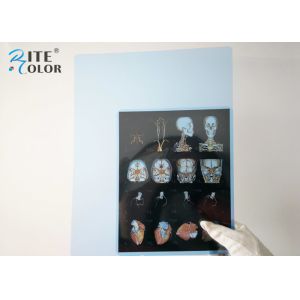 Inkjet Blue Radiology Medical Imaging Film