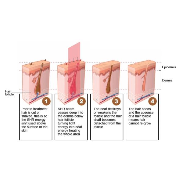 CE Approved Facial Equipment Intense Pulse Light OPT IPL Laser Hair Removal Device