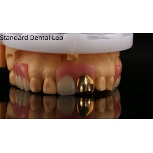 Full Acrylic Dentures With Yellow Gold Teeth/Dental Temporary Acrylic Denture