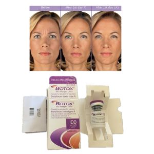 China Injections Allergan Botulinum Toxin 100IU Anti Wrinkles Dermal Filler on sale