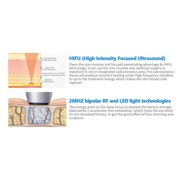 Led High Intensity Focused Ultrasound Rf Facial Machine
