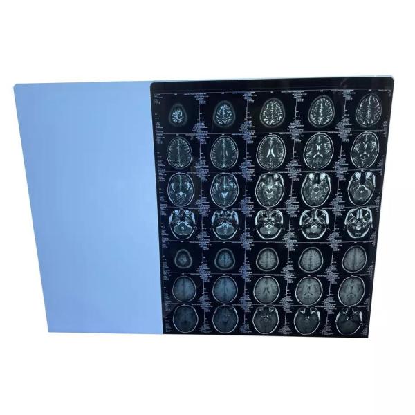 Buy Anti Static Medical Dry Film Fuji Laser Imaging Film 25cmx35cm at wholesale prices