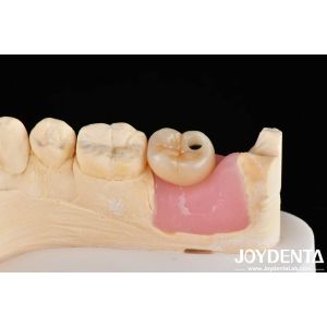 Internal Hex Titanium Dental Implants Precision Machining With Zero Angulation