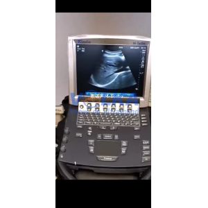 Sonosite M-Turbo Original Ultrasound Mainboard P12095-15*A