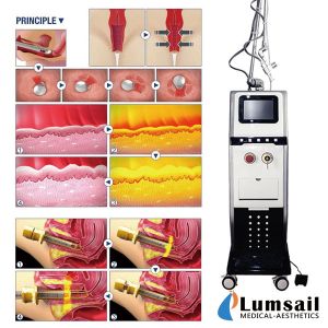 Vaginal Tightening Fractional Co2 Laser Machine 10600nm