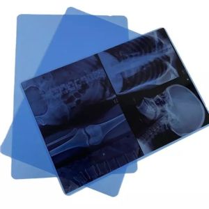 Medical X Ray Film For Fuji Drypix Printer