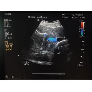 ATL Clearvue original convex array ultrasound probe C5-2