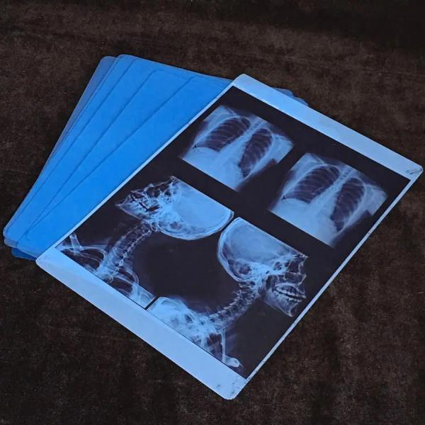 9600x2400dpi Inkjet X Ray Film PET Blue Transparent For High Resolution Medical Imaging