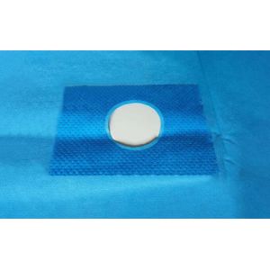 China SMS Coated Sterile Aperture Drape Medical Disposable Surgical With Hole on sale