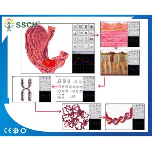 Russian Version Metatron NLS Hunter