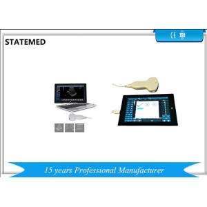 Convex Probe Type Portable Ultrasound Equipment Digital High Resolution Image