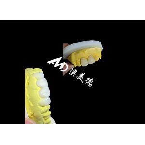 Custom Translucent Zirconia dental Crowns Crafted by AMD Dental Lab