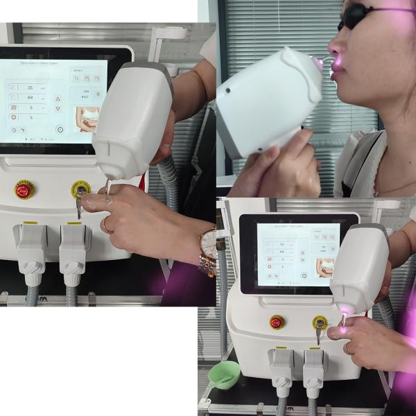 Permanent Hair Removal Diode Laser Machine 1200W For All Skin Types