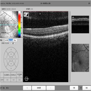 TUV Optical Coherence Tomography Scanner Spectral Domain Machine