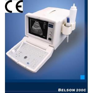 Hospital Ultrasound Machine Portable Ultrasound Scanner with Dual Probe