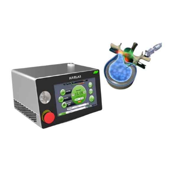 Herniated Intervertebral Disc PLDD Laser