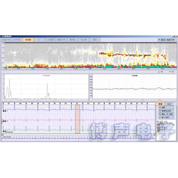 12 Channels Holter ECG Recorder 24 Hours Ambulatory Digital Holter Monitor for CARDIOSCAN Analysis Software