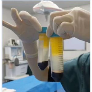 5500RPM Swing Out Rotor Medical Centrifuge Machine Benchtop 2000ml