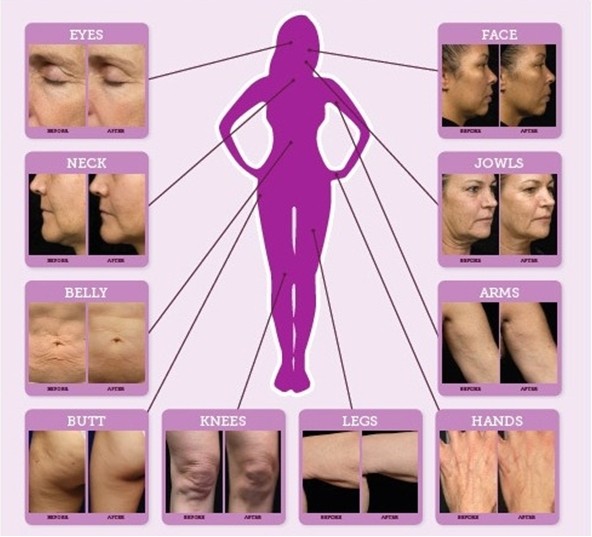 application parts.jpg