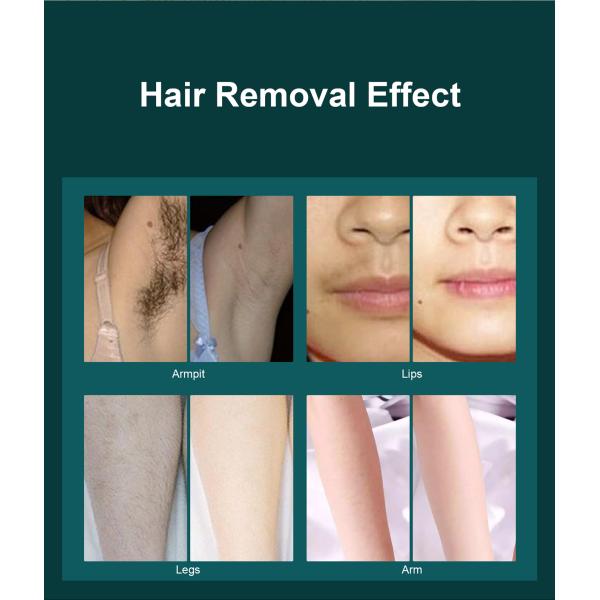 Freezing Point Laser IPL Hair Removal Epilator 990000 Flashes Home Use Portable Ice Cool Painless Hair Remove Device Dep