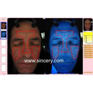 3D facial magic mirror skin analyzer with professional camera