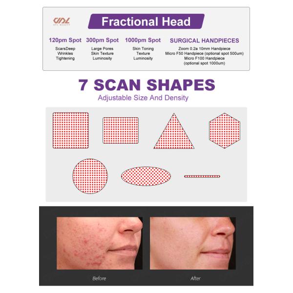 ZGV13-02 Fractional CO2 RF Tube laser machine Private Laser black color salon beauty machine