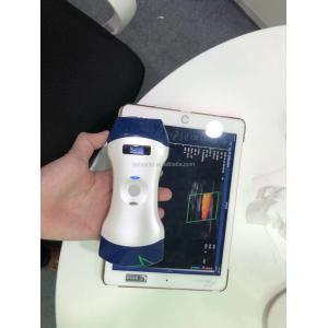 Wifi Ultrasound Probe Convex Linear Phasedarray 80/128/192 Color Doppler