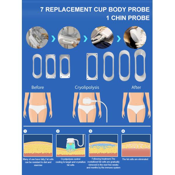 Cryolipolysis Machine Cryo Lipolaser RF Cavitation 4 In 1 Fat Freezer System For Body Slimming