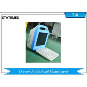 Mobile Ophthalmic Ultrasound Machines , B Ultrasound Scanner Stable Performance