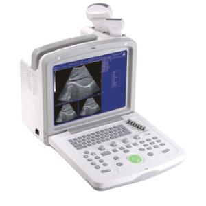 CMS600B-3 B-Ultrasound Diagnostic Scanner