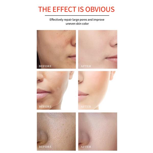 Glycerin Vitamin C Skincare Face Serum Products Anti Wrinkle Tightening Anti Puffiness