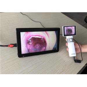 1920x1080 Digital Video Dermatoscope
