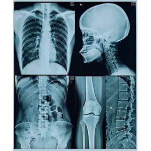 14x17 Inch Fuji X Ray Film