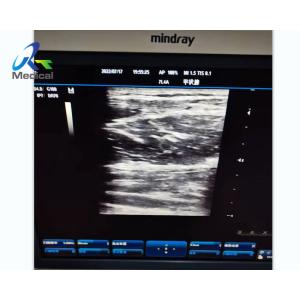 China Abnormal Image Ultrasound Machine Repair Service Mindray DC-3 on sale