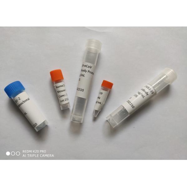 Buy Recombinant 2019-NCoV Mouse Monoclonal Antibody Spike RBD Protein at wholesale prices