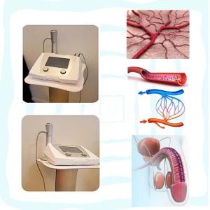 Shock wave therapy equipment medical shockwave erectile dysfunction shock wave