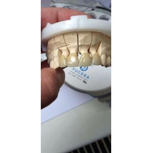 Yucera ST color 3D Multilayer Zirconia Block - Precision - Engineered for CAD