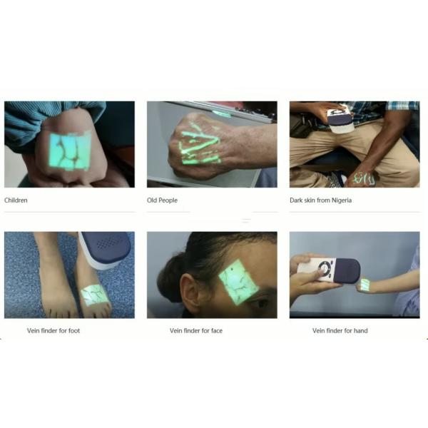 5V Portable Medical Vein Finder Scanner Machine 15-25cm Range 280g