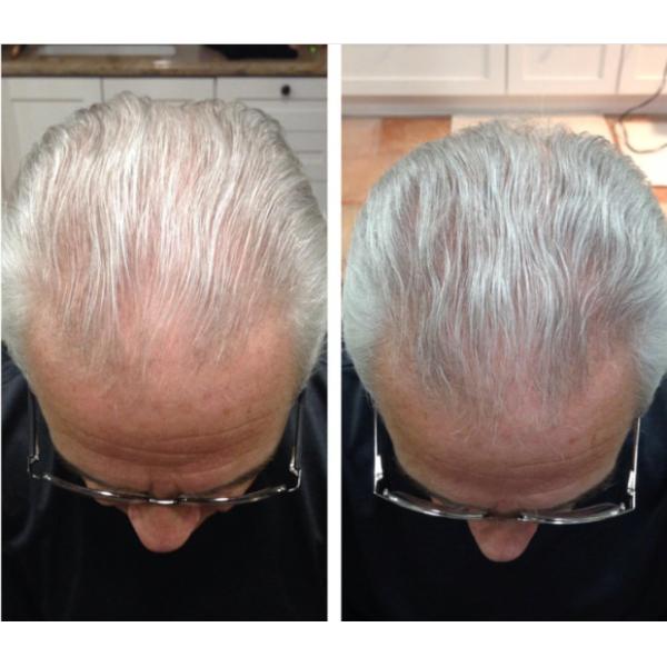 Buy Hair growth oil at wholesale prices