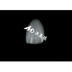 Natural Esthetics EMAX Veneer Highly Staining Resistant EMAX Ceramic Veneers