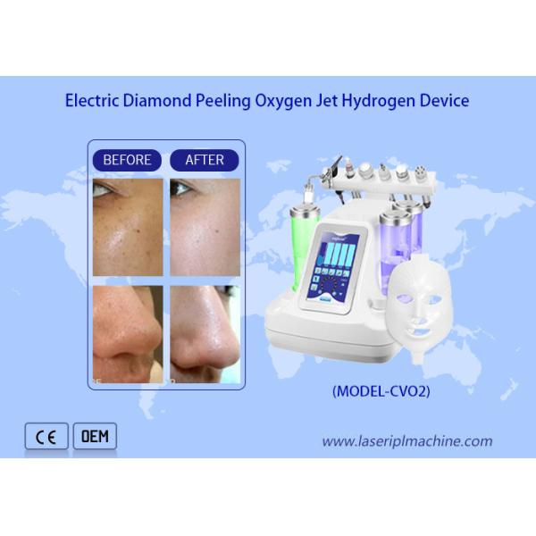 Facial Deep Cleaning Water Oxygen Jet Peel Machine / hydro Dermabrasion water