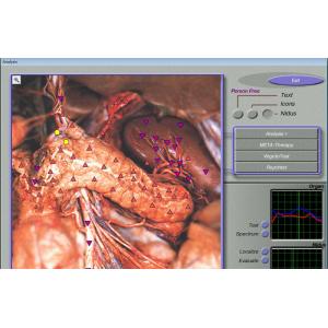 Quantum Resonance 3d Nls Health Analyzer For Body Detection