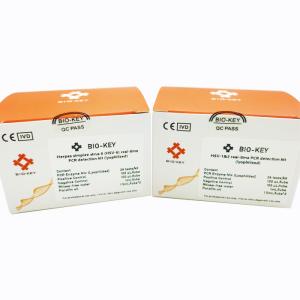 Quality Herpes Simplex Virus 6 HSV-6 96tests/Kit Real Time PCR Detection Kit Lyophilized for sale